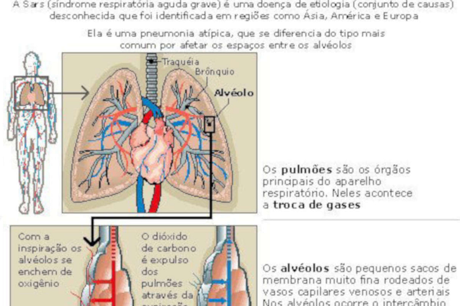 Sars vírus da pneumonia asiática no corpo humano - destacada