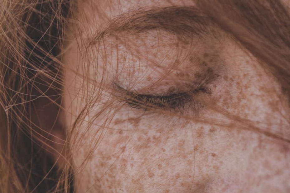 Como prevenir o câncer de pele - destacada